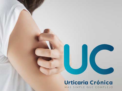 Urticaria Crónica