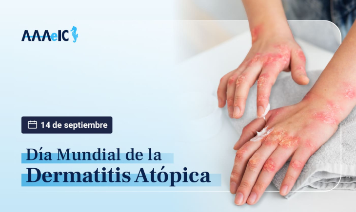 14 de septiembre: Día Mundial de la Dermatitis Atópica
